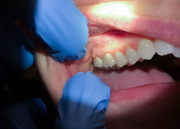 Best Emergency Treatment for Toothache in Greenville, VA